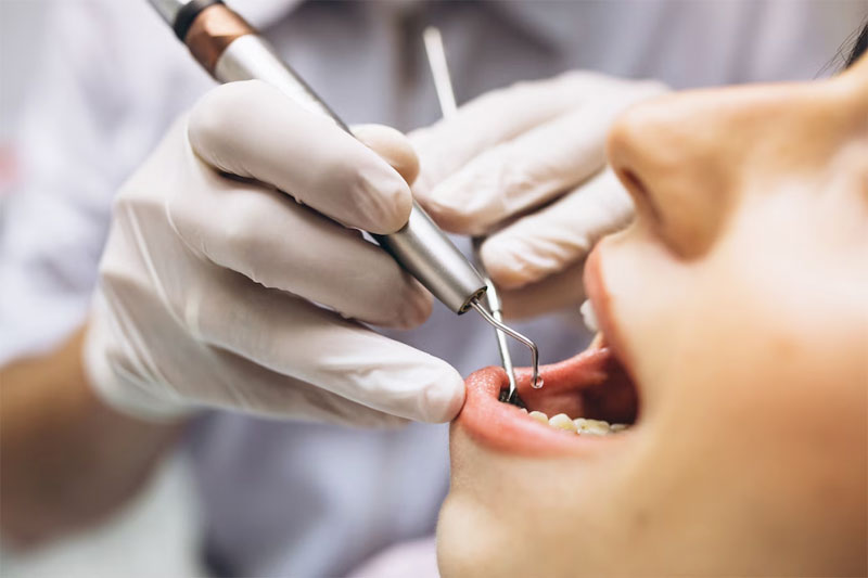 What Instructions Do You Need To Follow After Tooth Extraction?